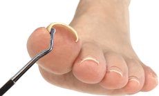 画像5: Rooro　巻き爪ペディファイル&クリーナー ［メール便OK］ (5)