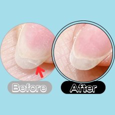 画像2: PRESTO ポイントリペアジェル 3.5g［メール便OK］ (2)